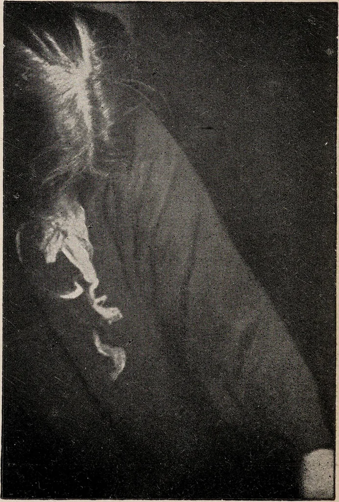An illustration from Phenomena of materialisation : a contribution to the investigation of mediumistic teleplastics / by Baron von Schrenck Notzing ; translated by E.E. Fournier d'Albe., 1923, leaf 518
