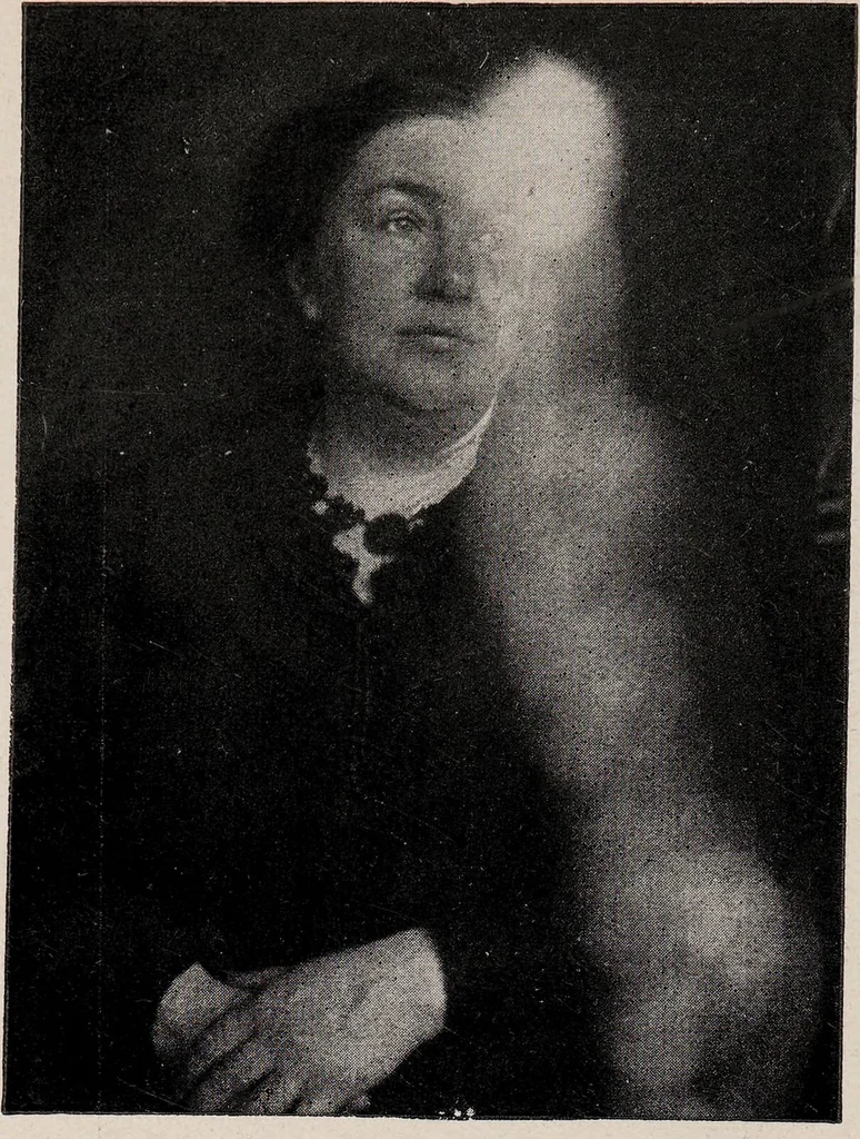 An illustration from Phenomena of materialisation : a contribution to the investigation of mediumistic teleplastics / by Baron von Schrenck Notzing ; translated by E.E. Fournier d'Albe., 1923, leaf 524