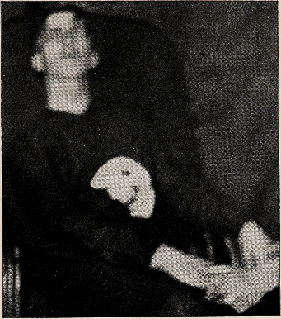 An illustration from Phenomena of materialisation : a contribution to the investigation of mediumistic teleplastics / by Baron von Schrenck Notzing ; translated by E.E. Fournier d'Albe., 1923, leaf 525