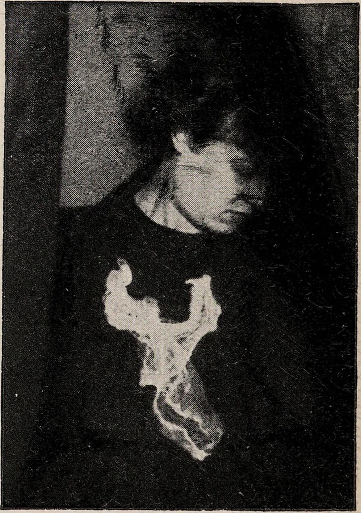 An illustration from Phenomena of materialisation : a contribution to the investigation of mediumistic teleplastics / by Baron von Schrenck Notzing ; translated by E.E. Fournier d'Albe., 1923, leaf 526