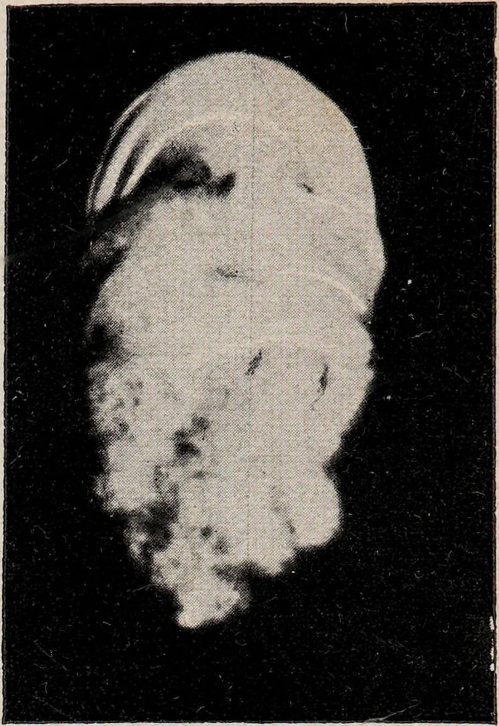 An illustration from Phenomena of materialisation : a contribution to the investigation of mediumistic teleplastics / by Baron von Schrenck Notzing ; translated by E.E. Fournier d'Albe., 1923, leaf 526