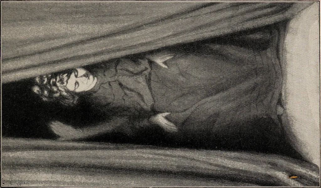 An illustration from Phenomena of materialisation : a contribution to the investigation of mediumistic teleplastics / by Baron von Schrenck Notzing ; translated by E.E. Fournier d'Albe., 1923, leaf 87