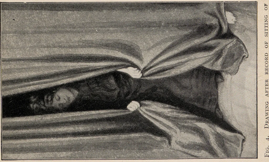 An illustration from Phenomena of materialisation : a contribution to the investigation of mediumistic teleplastics / by Baron von Schrenck Notzing ; translated by E.E. Fournier d'Albe., 1923, leaf 87