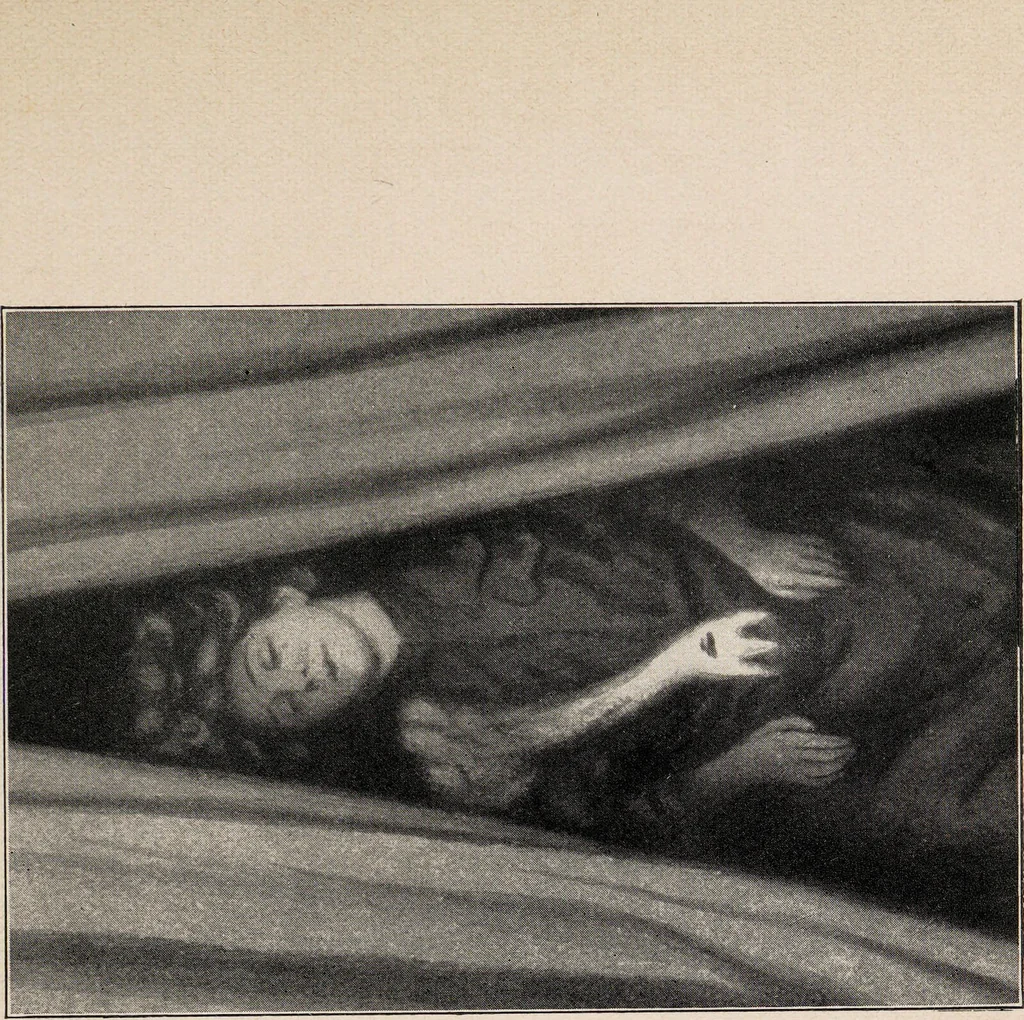 An illustration from Phenomena of materialisation : a contribution to the investigation of mediumistic teleplastics / by Baron von Schrenck Notzing ; translated by E.E. Fournier d'Albe., 1923, leaf 93