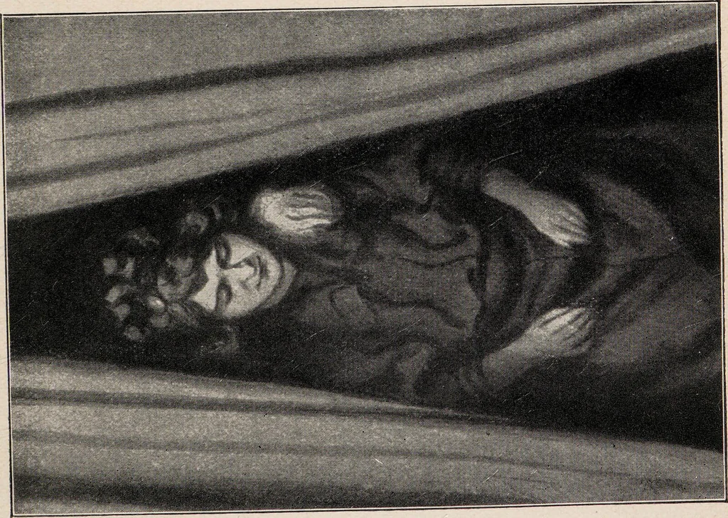 An illustration from Phenomena of materialisation : a contribution to the investigation of mediumistic teleplastics / by Baron von Schrenck Notzing ; translated by E.E. Fournier d'Albe., 1923, leaf 93