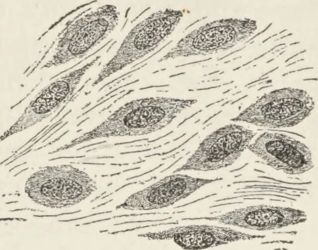 An illustration from A text-book of pathology / by Alfred Stengel ; with 394 illustrations in the text, many of them in colors, and 7 full-page chromolithographic plates., 1903, leaf 129
