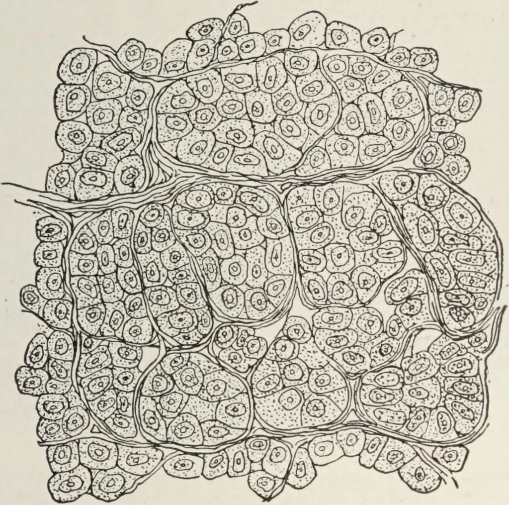 An illustration from A text-book of pathology / by Alfred Stengel ; with 394 illustrations in the text, many of them in colors, and 7 full-page chromolithographic plates., 1903, leaf 163