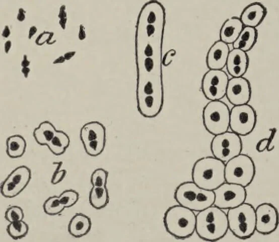 An illustration from A text-book of pathology / by Alfred Stengel ; with 394 illustrations in the text, many of them in colors, and 7 full-page chromolithographic plates., 1903, leaf 232