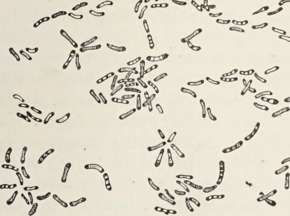 An illustration from A text-book of pathology / by Alfred Stengel ; with 394 illustrations in the text, many of them in colors, and 7 full-page chromolithographic plates., 1903, leaf 235