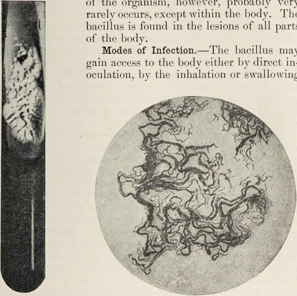 An illustration from A text-book of pathology / by Alfred Stengel ; with 394 illustrations in the text, many of them in colors, and 7 full-page chromolithographic plates., 1903, leaf 253