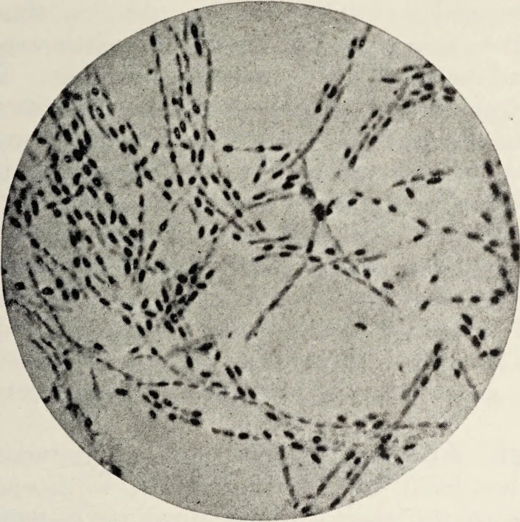 An illustration from A text-book of pathology / by Alfred Stengel ; with 394 illustrations in the text, many of them in colors, and 7 full-page chromolithographic plates., 1903, leaf 271