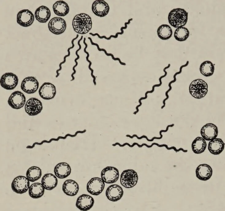 An illustration from A text-book of pathology / by Alfred Stengel ; with 394 illustrations in the text, many of them in colors, and 7 full-page chromolithographic plates., 1903, leaf 284
