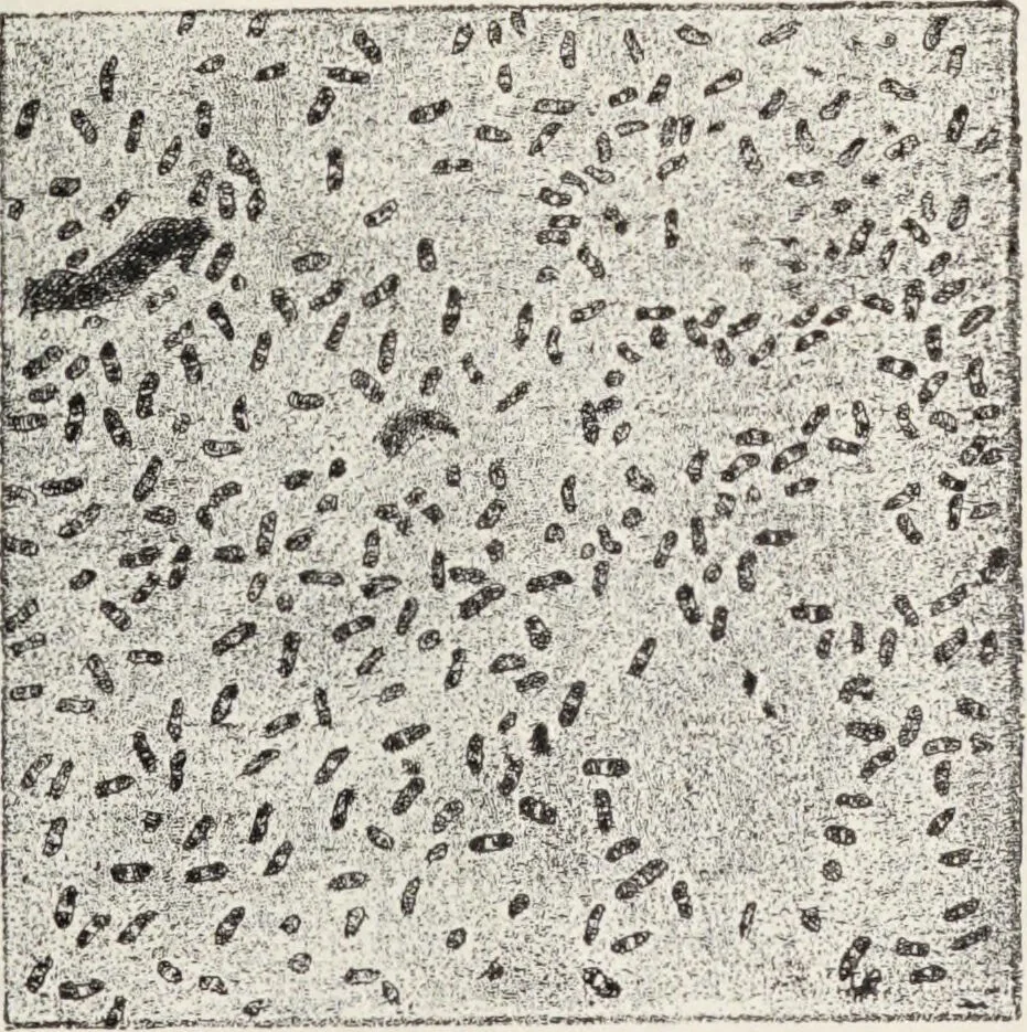 An illustration from A text-book of pathology / by Alfred Stengel ; with 394 illustrations in the text, many of them in colors, and 7 full-page chromolithographic plates., 1903, leaf 285