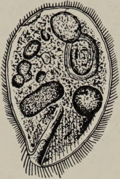 An illustration from A text-book of pathology / by Alfred Stengel ; with 394 illustrations in the text, many of them in colors, and 7 full-page chromolithographic plates., 1903, leaf 306