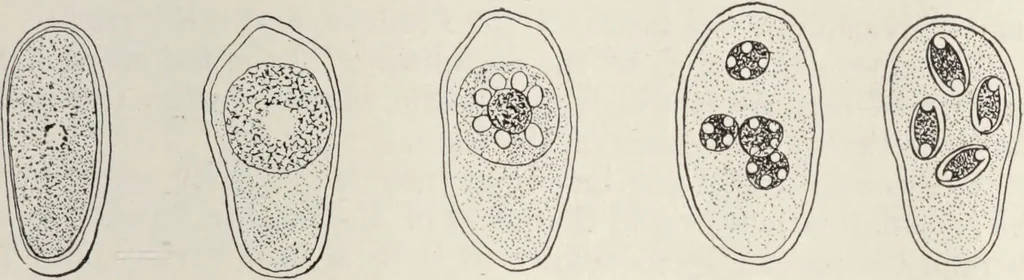 An illustration from A text-book of pathology / by Alfred Stengel ; with 394 illustrations in the text, many of them in colors, and 7 full-page chromolithographic plates., 1903, leaf 313