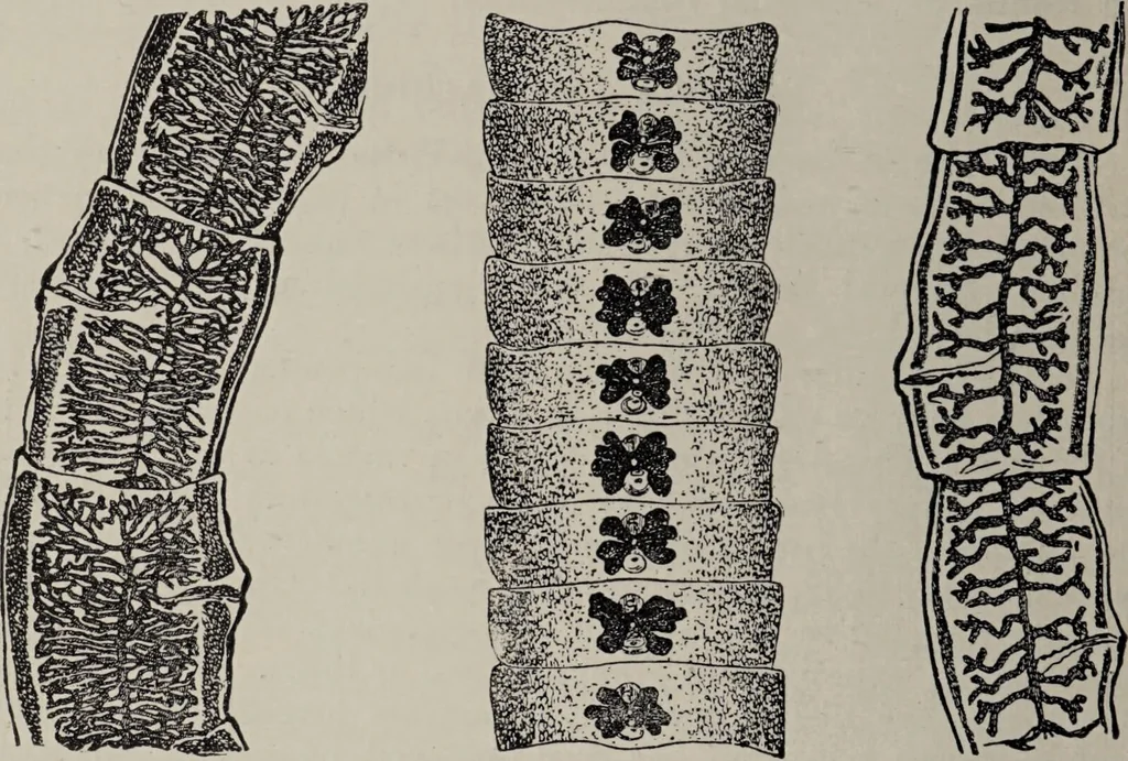 An illustration from A text-book of pathology / by Alfred Stengel ; with 394 illustrations in the text, many of them in colors, and 7 full-page chromolithographic plates., 1903, leaf 318