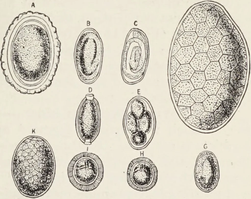 An illustration from A text-book of pathology / by Alfred Stengel ; with 394 illustrations in the text, many of them in colors, and 7 full-page chromolithographic plates., 1903, leaf 319