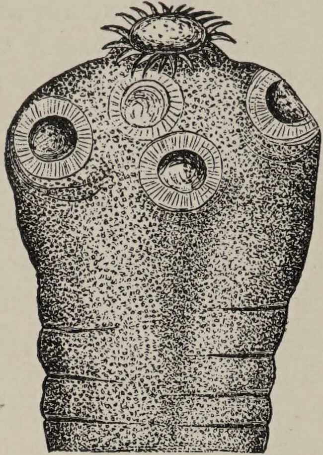 An illustration from A text-book of pathology / by Alfred Stengel ; with 394 illustrations in the text, many of them in colors, and 7 full-page chromolithographic plates., 1903, leaf 320