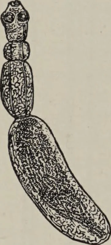 An illustration from A text-book of pathology / by Alfred Stengel ; with 394 illustrations in the text, many of them in colors, and 7 full-page chromolithographic plates., 1903, leaf 324