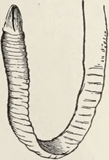 An illustration from A text-book of pathology / by Alfred Stengel ; with 394 illustrations in the text, many of them in colors, and 7 full-page chromolithographic plates., 1903, leaf 327