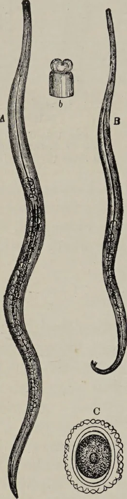 An illustration from A text-book of pathology / by Alfred Stengel ; with 394 illustrations in the text, many of them in colors, and 7 full-page chromolithographic plates., 1903, leaf 328