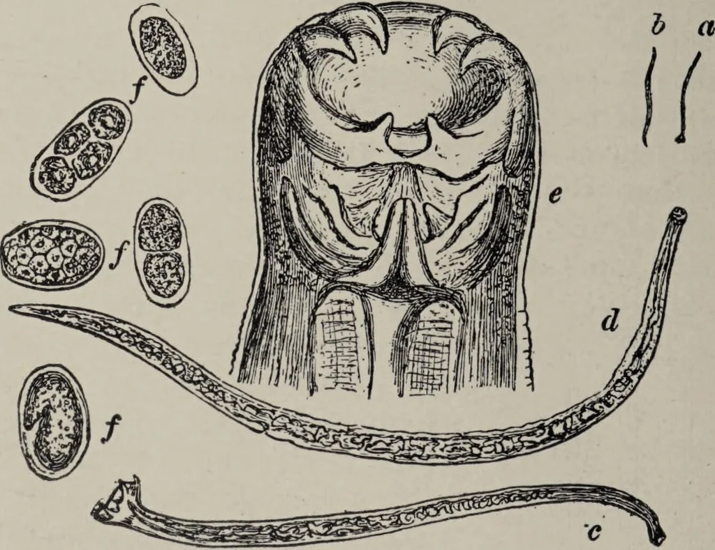 An illustration from A text-book of pathology / by Alfred Stengel ; with 394 illustrations in the text, many of them in colors, and 7 full-page chromolithographic plates., 1903, leaf 330