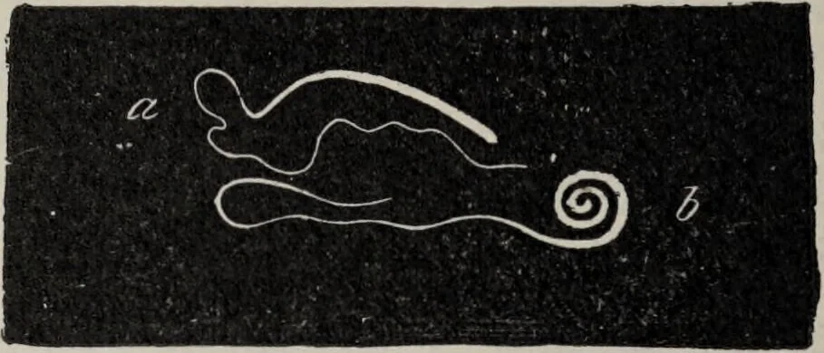An illustration from A text-book of pathology / by Alfred Stengel ; with 394 illustrations in the text, many of them in colors, and 7 full-page chromolithographic plates., 1903, leaf 332