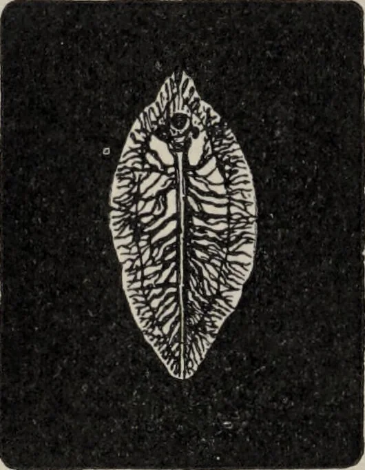 An illustration from A text-book of pathology / by Alfred Stengel ; with 394 illustrations in the text, many of them in colors, and 7 full-page chromolithographic plates., 1903, leaf 336