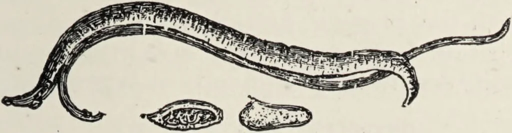 An illustration from A text-book of pathology / by Alfred Stengel ; with 394 illustrations in the text, many of them in colors, and 7 full-page chromolithographic plates., 1903, leaf 337