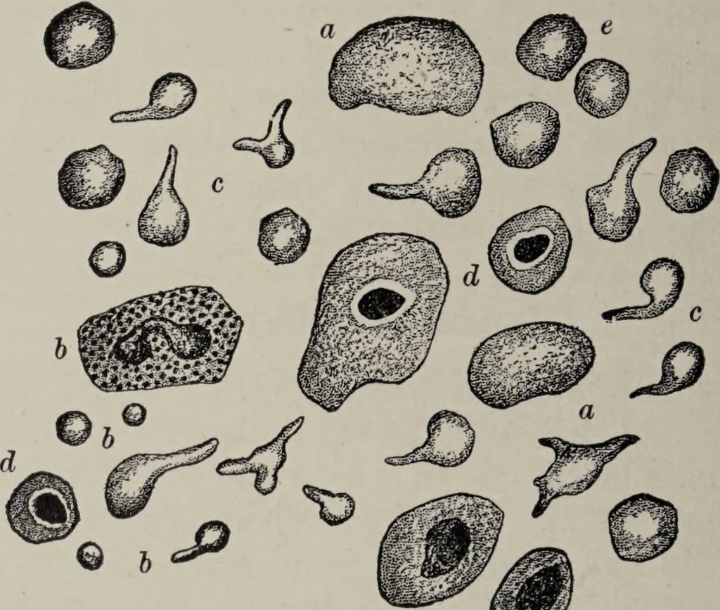 An illustration from A text-book of pathology / by Alfred Stengel ; with 394 illustrations in the text, many of them in colors, and 7 full-page chromolithographic plates., 1903, leaf 346