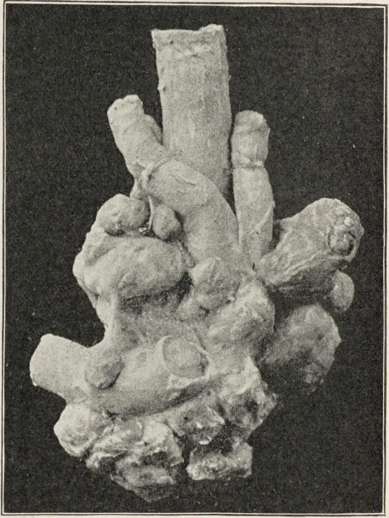 An illustration from A text-book of pathology / by Alfred Stengel ; with 394 illustrations in the text, many of them in colors, and 7 full-page chromolithographic plates., 1903, leaf 385