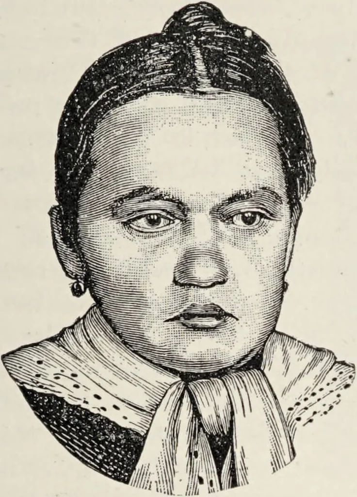 An illustration from A text-book of pathology / by Alfred Stengel ; with 394 illustrations in the text, many of them in colors, and 7 full-page chromolithographic plates., 1903, leaf 395