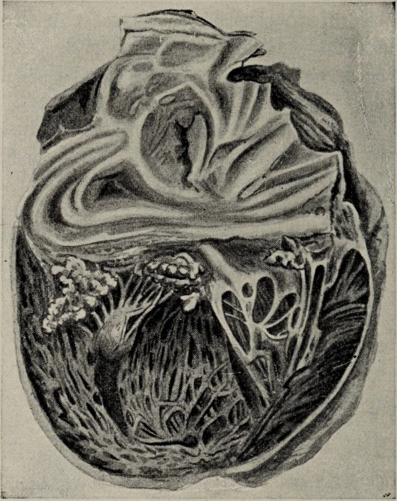 An illustration from A text-book of pathology / by Alfred Stengel ; with 394 illustrations in the text, many of them in colors, and 7 full-page chromolithographic plates., 1903, leaf 400
