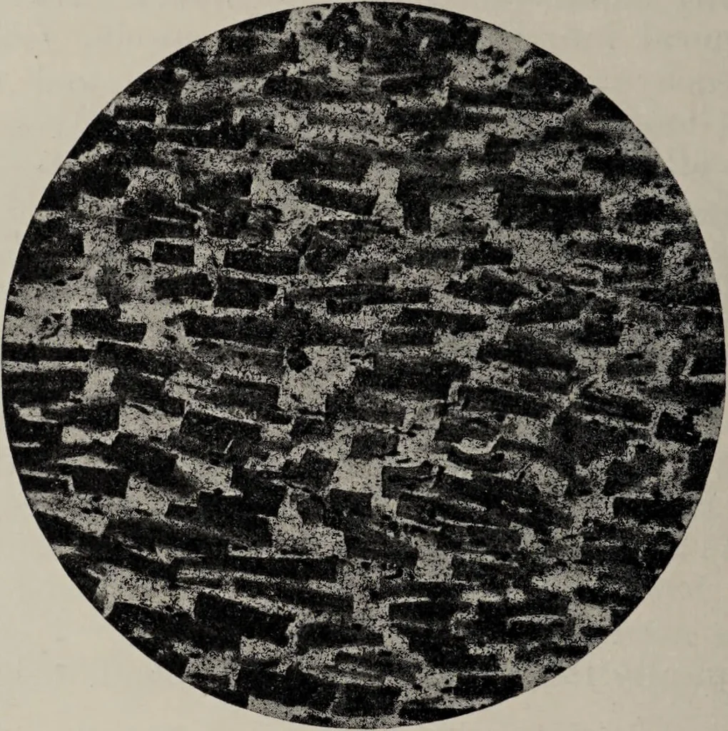 An illustration from A text-book of pathology / by Alfred Stengel ; with 394 illustrations in the text, many of them in colors, and 7 full-page chromolithographic plates., 1903, leaf 410