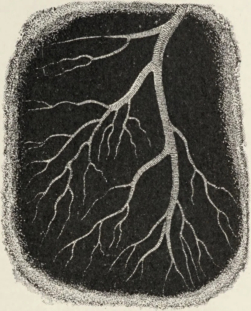 An illustration from A text-book of pathology / by Alfred Stengel ; with 394 illustrations in the text, many of them in colors, and 7 full-page chromolithographic plates., 1903, leaf 459