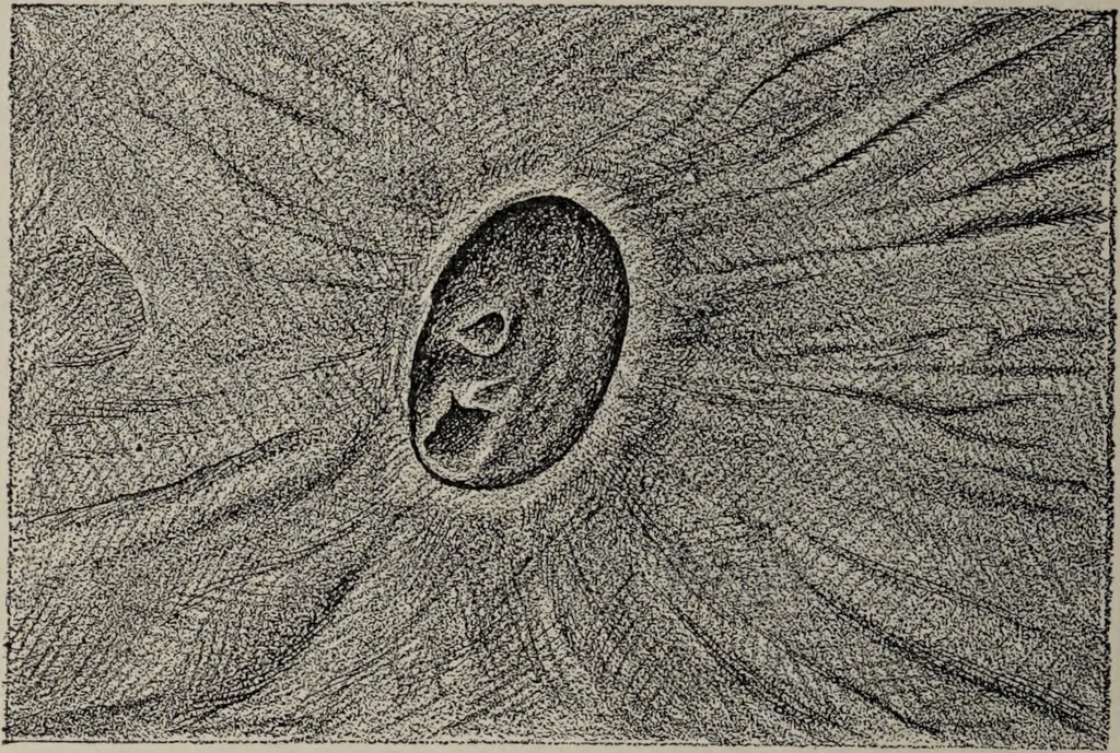 An illustration from A text-book of pathology / by Alfred Stengel ; with 394 illustrations in the text, many of them in colors, and 7 full-page chromolithographic plates., 1903, leaf 548