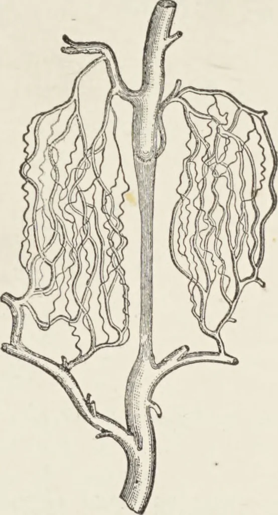 An illustration from A text-book of pathology / by Alfred Stengel ; with 394 illustrations in the text, many of them in colors, and 7 full-page chromolithographic plates., 1903, leaf 57