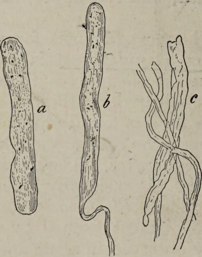An illustration from A text-book of pathology / by Alfred Stengel ; with 394 illustrations in the text, many of them in colors, and 7 full-page chromolithographic plates., 1903, leaf 652