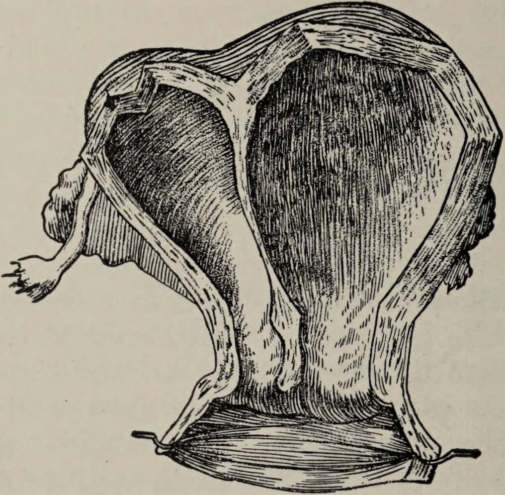 An illustration from A text-book of pathology / by Alfred Stengel ; with 394 illustrations in the text, many of them in colors, and 7 full-page chromolithographic plates., 1903, leaf 688