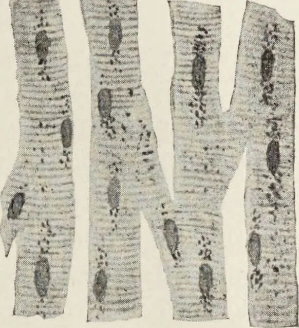 An illustration from A text-book of pathology / by Alfred Stengel ; with 394 illustrations in the text, many of them in colors, and 7 full-page chromolithographic plates., 1903, leaf 73