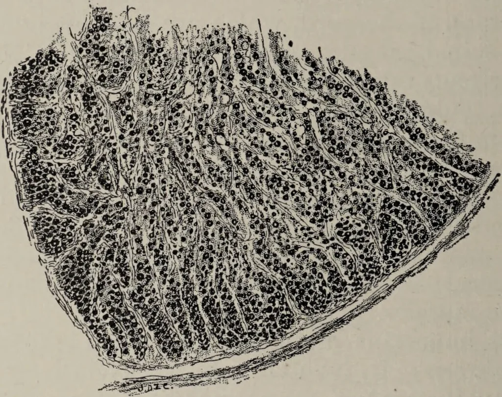 An illustration from A text-book of pathology / by Alfred Stengel ; with 394 illustrations in the text, many of them in colors, and 7 full-page chromolithographic plates., 1903, leaf 872