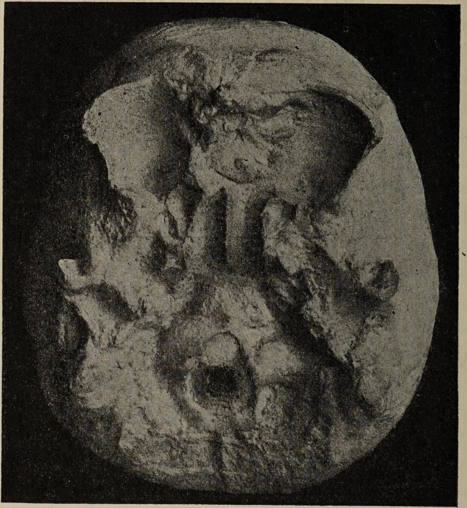 An illustration from Franz Joseph Gall / von P. J. Möbius., 1905, leaf 242