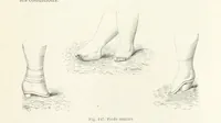 Picture 145 of 334 from Les Races Humaines ... Ouvrage illustré de 334 gravures dessinées sur bois, et de 8 chromo-lithographies, etc (1872), leaf 313