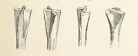 An illustration from A Text-book of Ore and Stone Mining ... With frontispiece and 716 illustrations (1894)