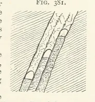 An illustration from A Text-book of Ore and Stone Mining ... With frontispiece and 716 illustrations (1894)
