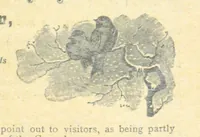 Picture 82 of 178 from Thrilling Life Stories for the Masses (1892), leaf 229