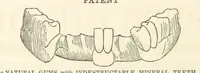 An illustration from Pawson and Brailsford's Illustrated Guide to Sheffield and neighbourhood, etc (1862)