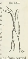 An illustration from Works. Popular edition.] 2 series (1886)