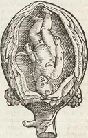 Picture 28 of 273 from Vlyssis Aldrovandi Patricii Bononiensis Monstrorvm Historia: cum Indice copiosissimo (1642), leaf 72
