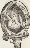Picture 32 of 273 from Vlyssis Aldrovandi Patricii Bononiensis Monstrorvm Historia: cum Indice copiosissimo (1642), leaf 74
